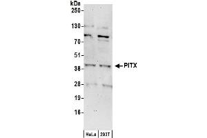 Western Blotting (WB) image for anti-Paired-Like Homeodomain 1 (PITX1) (AA 50-100) antibody (ABIN7450568)