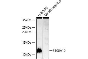 Western blot analysis of extracts of various cell lines, using S100 antibody (ABIN3015803, ABIN3015804, ABIN3015805, ABIN1682607 and ABIN6219148) at 1:400 dilution.