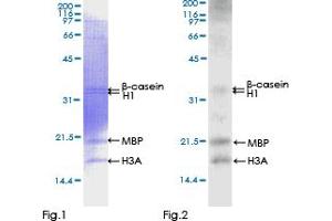 Kinase Activity Assay (KAA) image for Calcium/calmodulin-Dependent Protein Kinase II gamma (CAMK2G) (AA 1-527) protein (GST tag) (ABIN1347937)