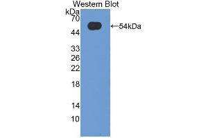 Western blot analysis of the recombinant protein. (Oncostatin M anticorps  (AA 26-220))