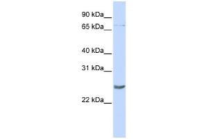 WB Suggested Anti-PRDM5 Antibody Titration:  0. (PRDM5 anticorps  (Middle Region))