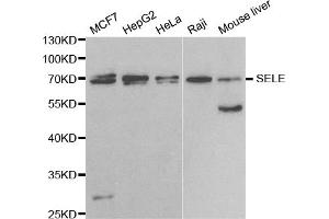 Western blot analysis of extracts of various cell lines, using SELE antibody. (Selectin E/CD62e anticorps)