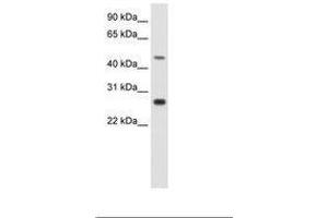 Image no. 1 for anti-Spermatogenic Leucine Zipper 1 (SPZ1) (C-Term) antibody (ABIN202383) (SPZ1 anticorps  (C-Term))