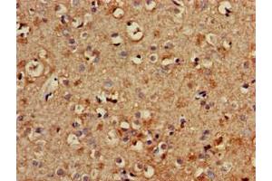 Immunohistochemistry of paraffin-embedded human brain tissue using ABIN7174052 at dilution of 1:100 (TYRO3 anticorps  (AA 728-873))