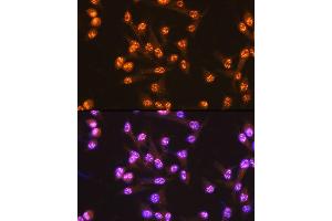 Immunofluorescence analysis of HeLa cells using Cdc25C Rabbit mAb (ABIN7266251) at dilution of 1:100 (40x lens).