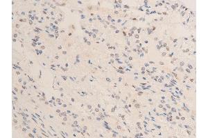 ABIN6267253 at 1/100 staining human TB tissue sections by IHC-P. (CHEK2 anticorps  (pThr68))