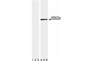 Western blot analysis of NF-kappaB p65 (pS536) in transformed human epithelioid carcinoma. (NF-kB p65 anticorps  (pSer536))