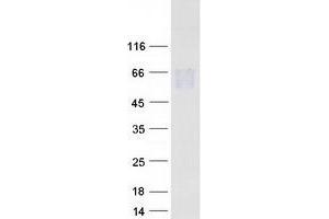 Validation with Western Blot