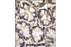 TNFRSF1A Antibody (N-term) (ABIN655208 and ABIN2844822) immunohistochemistry analysis in formalin fixed and paraffin embedded human rectum tissue followed by peroxidase conjugation of the secondary antibody and DAB staining.