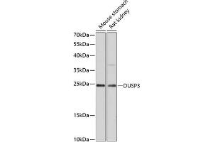 Western blot analysis of extracts of various cell lines, using DUSP3 antibody (ABIN6127792, ABIN6139873, ABIN6139874 and ABIN6215639) at 1:3000 dilution. (Dual Specificity Phosphatase 3 (DUSP3) (AA 1-185) anticorps)