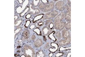 Immunohistochemical staining of human kidney with C11orf86 polyclonal antibody  shows strong cytoplasmic positivity in subsets of tubules at 1:50-1:200 dilution. (C11ORF86 anticorps)