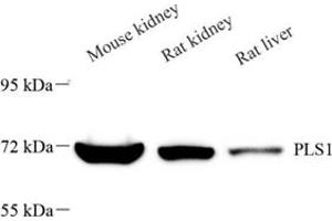 Western blot analysis of PLS1 (ABIN7075096),at dilution of 1: 2000