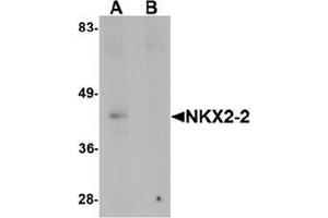 Western blot analysis of NKX2-2 in rat kidney tissue lysate with NKX2-2 antibody at 1 ug/mL in (A) the absence and (B) the presence of blocking peptide.