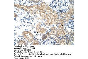 Rabbit Anti-NXF5 Antibody  Paraffin Embedded Tissue: Human Kidney Cellular Data: Epithelial cells of renal tubule Antibody Concentration: 4. (NXF5 anticorps  (Middle Region))
