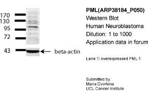 Western Blotting (WB) image for anti-Promyelocytic Leukemia (PML) (Middle Region) antibody (ABIN501870) (PML anticorps  (Middle Region))