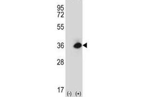 Western blot analysis of Rage antibody and 293 cell lysate (2 ug/lane) either nontransfected (Lane 1) or transiently transfected (2) with the mouse Rage gene.