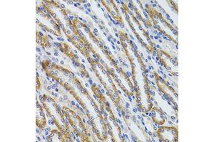 Immunohistochemistry of paraffin-embedded mouse kidney using HEXA antibody (ABIN6290114) at dilution of 1:100 (40x lens). (Hexosaminidase A anticorps)