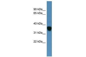 Western Blot showing AKR1C1 antibody used at a concentration of 1-2 ug/ml to detect its target protein. (AKR1C1 anticorps  (N-Term))