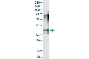 Immunoprecipitation of CLTB transfected lysate using anti-CLTB MaxPab rabbit polyclonal antibody and Protein A Magnetic Bead , and immunoblotted with CLTB purified MaxPab mouse polyclonal antibody (B01P) .