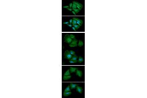 ICC/IF analysis of AK1 in HeLa cell line, stained with DAPI (Blue) for nucleus staining and monoclonal anti-human AK1 antibody (1:100) with goat anti-mouse IgG-Alexa fluor 488 conjugate (Green).