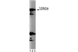 Western blot analysis of NFAT-1 on a Jurkat cell lysate (Human T-cell leukemia, ATCC TIB-152).