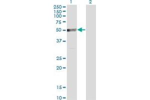 Western Blot analysis of TRIP6 expression in transfected 293T cell line by TRIP6 monoclonal antibody (M07), clone 3D12. (TRIP6 anticorps  (AA 1-100))