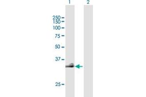 Western Blot analysis of HAS3 expression in transfected 293T cell line by HAS3 MaxPab polyclonal antibody. (HAS3 anticorps  (AA 1-281))