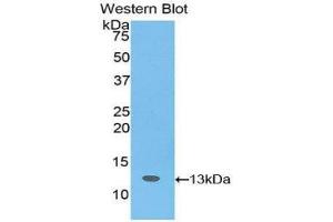 Western Blotting (WB) image for anti-Slit Homolog 3 (SLIT3) (AA 62-119) antibody (ABIN1176113) (SLIT3 anticorps  (AA 62-119))