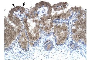 ASGR2 antibody was used for immunohistochemistry at a concentration of 4-8 ug/ml to stain Epithelial cells of intestinal villus (arrows) in Human Intestine. (Asialoglycoprotein Receptor 2 anticorps  (N-Term))