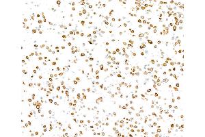 Immunocytochemistry (ICC) image for anti-Keratin 8 (KRT8) (C-Term) antibody (ABIN7795705)
