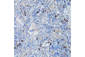 Immunohistochemistry of paraffin-embedded rat spleen using DDIT3/CHOP Rabbit pAb (ABIN6131562, ABIN6139460, ABIN6139463 and ABIN6215170) at dilution of 1:200 (40x lens). (DDIT3 anticorps  (AA 1-169))