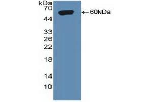 Detection of Recombinant SORT1, Human using Polyclonal Antibody to Sortilin 1 (SORT1) (Sortilin 1 anticorps  (AA 50-320))