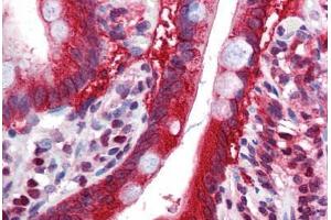 Human Small Intestine: Formalin-Fixed, Paraffin-Embedded (FFPE) (FTO anticorps  (N-Term))