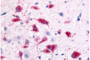 Anti-CRF1 antibody  ABIN1048461 IHC staining of rat hypothlalmus.