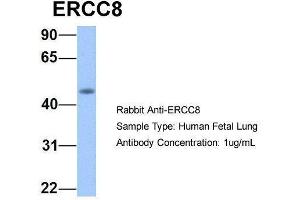 Host:  Rabbit  Target Name:  ERCC8  Sample Type:  Human Fetal Lung  Antibody Dilution:  1. (ERCC8 anticorps  (C-Term))