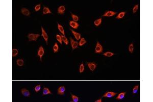 Immunofluorescence analysis of L929 cells using NRP1 Polyclonal Antibody at dilution of 1:100. (Neuropilin 1 anticorps)