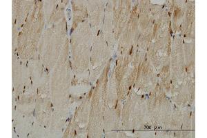 Immunoperoxidase of monoclonal antibody to TTN on formalin-fixed paraffin-embedded human skeletal muscle.