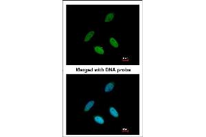 Immunofluorescence analysis of paraformaldehyde-fixed HeLa, using TAP antibody at 1:200 dilution.