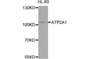Western blot analysis of extracts of HL-60 cells, using ATP2A1 antibody (ABIN4902981) at 1:1000 dilution.