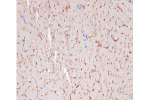 Immunohistochemistry of paraffin-embedded Mouse heart using CD36 Polyclonal Antibody at dilution of 1:200 (40x lens). (CD36 anticorps)