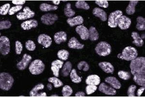 Immunofluoresence staining on 293 cells. (DEK anticorps  (AA 19-169))
