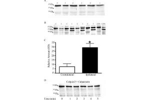 MetAP2 is cleaved by calpain in a rat middle cerebral arterial occlusion (MCAO) stroke model(A) Tissue harvested at 1 hour post-reperfusion did not show a difference in the formation of a proteolytic fragment between contralateral (C) and ipsilateral (I) brain.