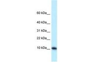 Image no. 1 for anti-Mediator Complex Subunit 21 (MED21) (AA 19-68) antibody (ABIN6747864) (MED21 anticorps  (AA 19-68))