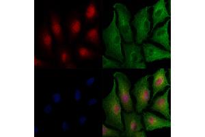 ABIN7093620 and ABIN7097645 staining  cells by IF/ICC.