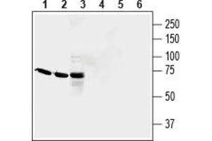 Pyroglutamylated RFamide Peptide Receptor (QRFPR) peptide
