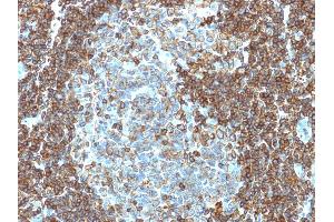 Formalin-fixed, paraffin-embedded human Tonsil stained with CD3e Mouse Monoclonal Antibody (PC3/188A).