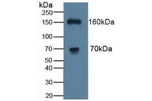 Detection of ATP7b in Human K562 Cells using Polyclonal Antibody to ATPase, Cu++ Transporting Beta Polypeptide (ATP7b) (ATP7B anticorps  (AA 59-426))