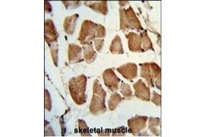Formalin-fixed and paraffin-embedded human skeletal muscle reacted with TAZ Antibody (N-term), which was peroxidase-conjugated to the secondary antibody, followed by DAB staining.