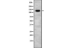 Western blot analysis of HIPK2 using 293 whole  lysates. (HIPK2 anticorps  (N-Term))