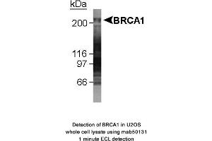 Image no. 1 for anti-Breast Cancer 1 (BRCA1) (AA 1314-1600), (AA 1314-1864) antibody (ABIN363285)